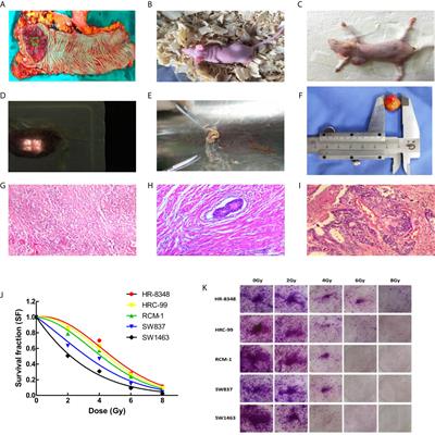 Screening of MicroRNA Related to Irradiation Response and the Regulation Mechanism of miRNA-96-5p in Rectal Cancer Cells